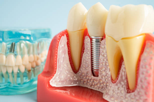 Our Range of Dental Services in Winneconne, WI